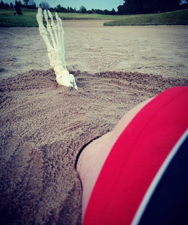 Девушка завела Instagram для своей ампутированной ноги (ФОТО)