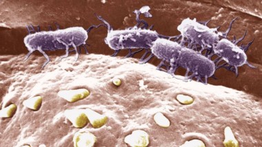 Микробиологи предрекли ужасный вирус, который может уничтожить более 90 процентов населения Земли