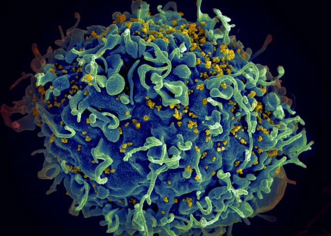 Японские ученые успешно испытали вакцину от ВИЧ