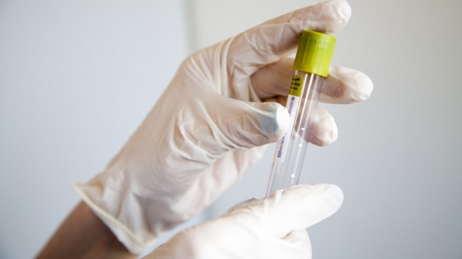 Ученые в Польше обнаружили вызывающий тяжелое течение коронавируса ген
