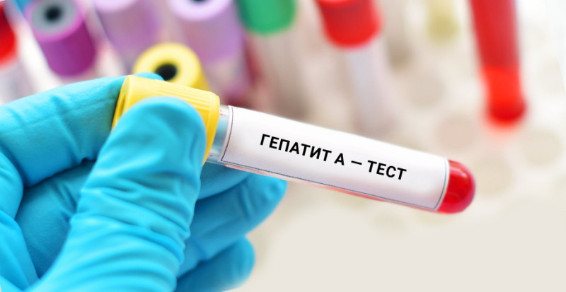 У Київській області зафіксували випадок захворювання на гепатит А